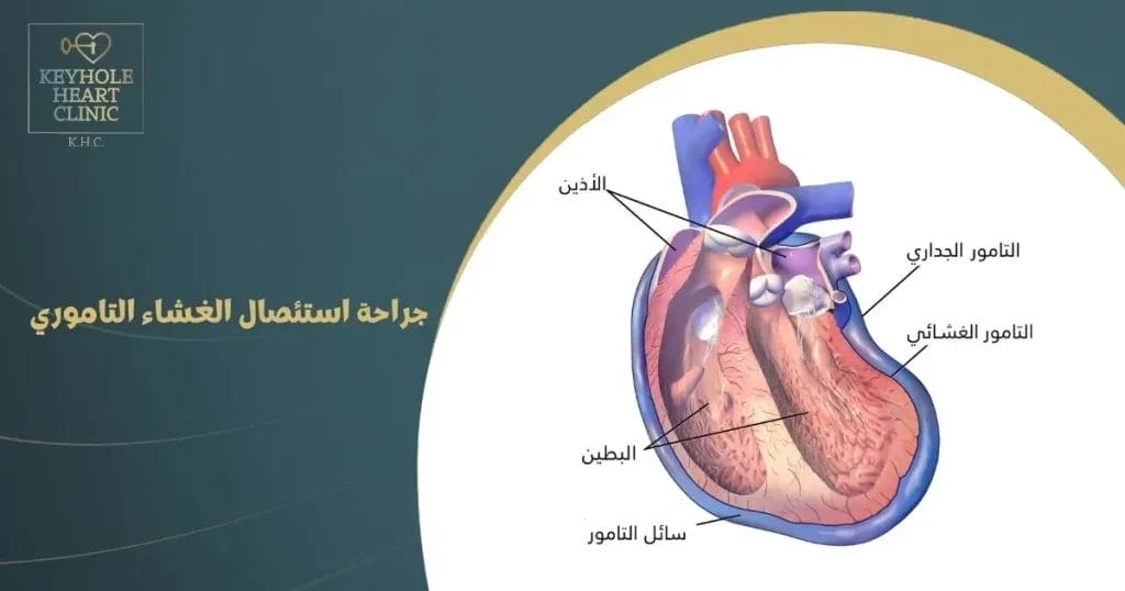 جراحة استئصال الغشاء التاموري