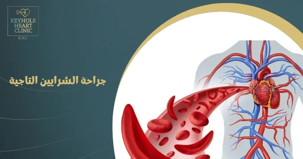 جراحة الشرايين التاجية