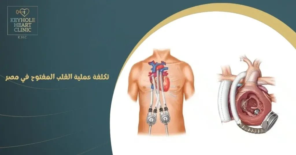 تكلفه عمليه القلب المفتوح في مصر