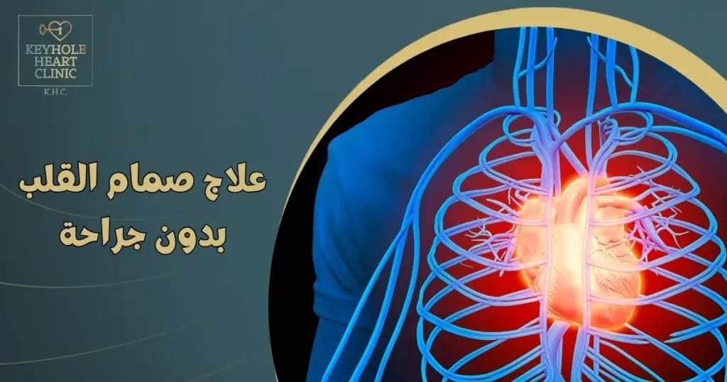 علاج صمام القلب بدون جراحة