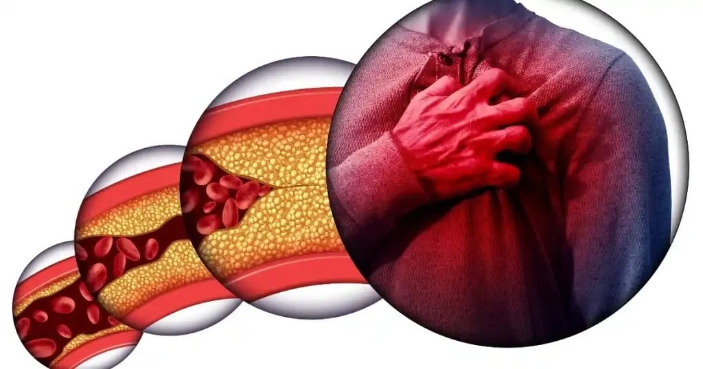 هل يمكن علاج صمامات القلب بالأدوية؟