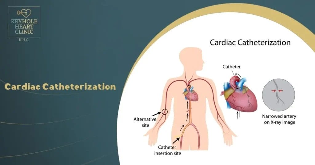 Cardiac Catheterization