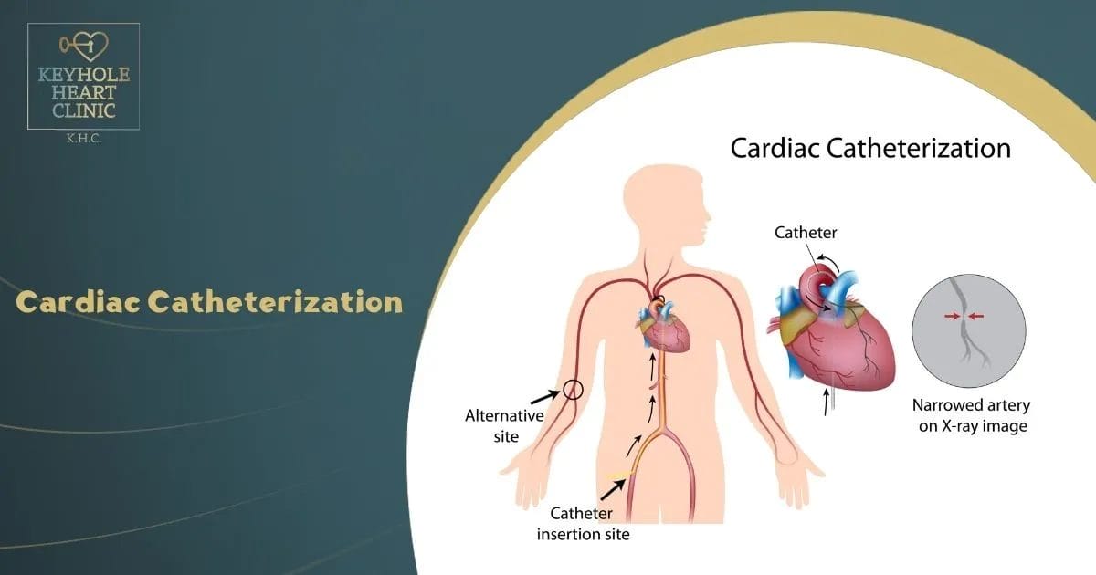 Cardiac Catheterization