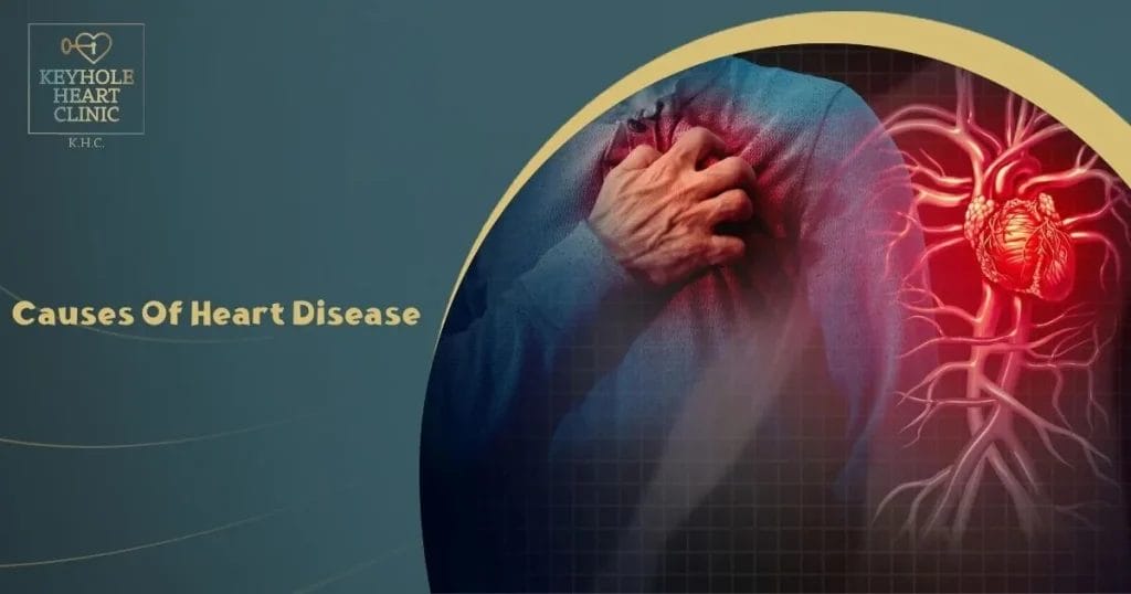 Causes Of Heart Disease