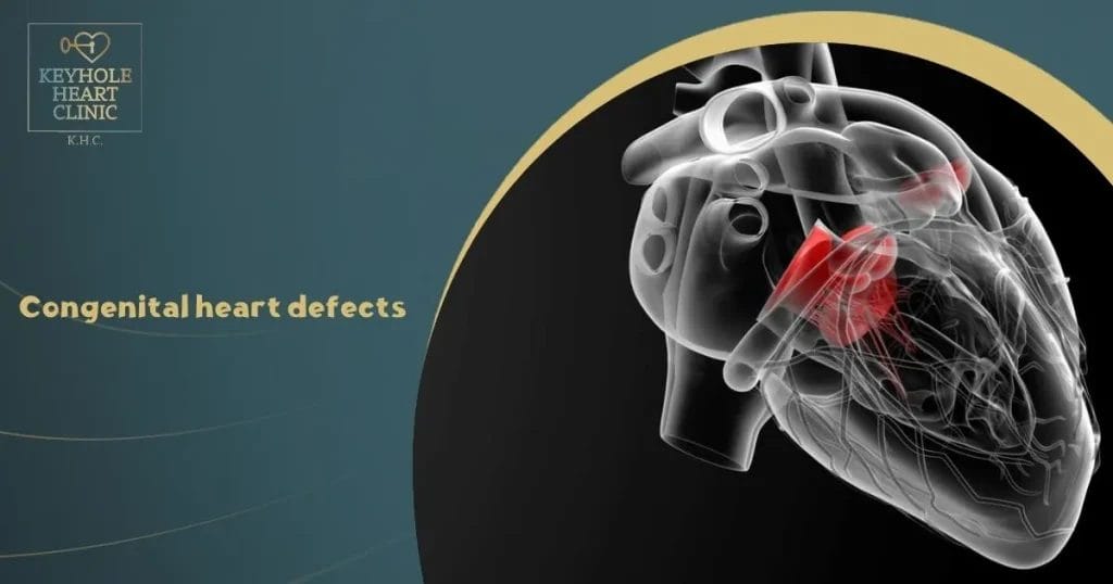 Congenital heart defects