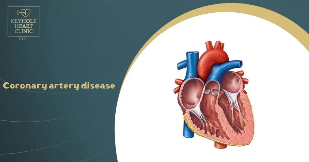Coronary artery disease
