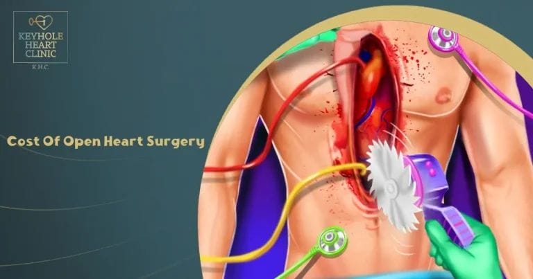 Cost Of Open Heart Surgery