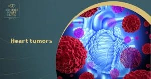 Heart tumors