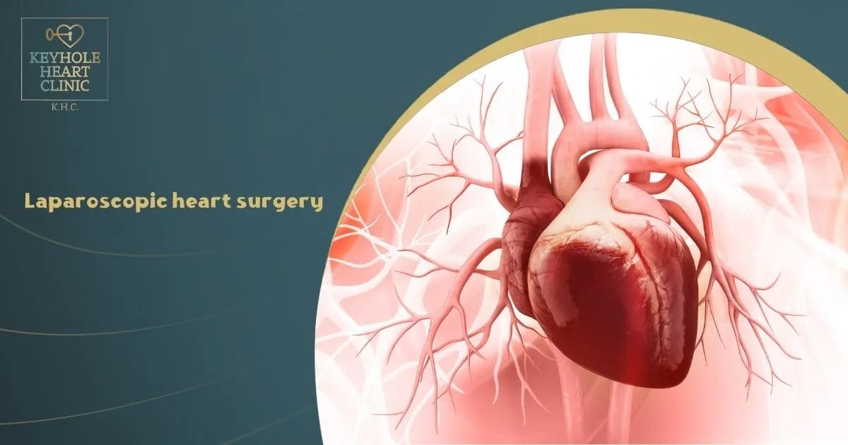 Laparoscopic heart surgery