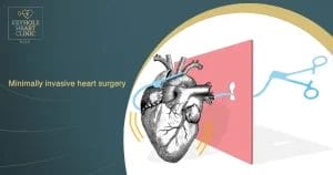 Minimally invasive heart surgery