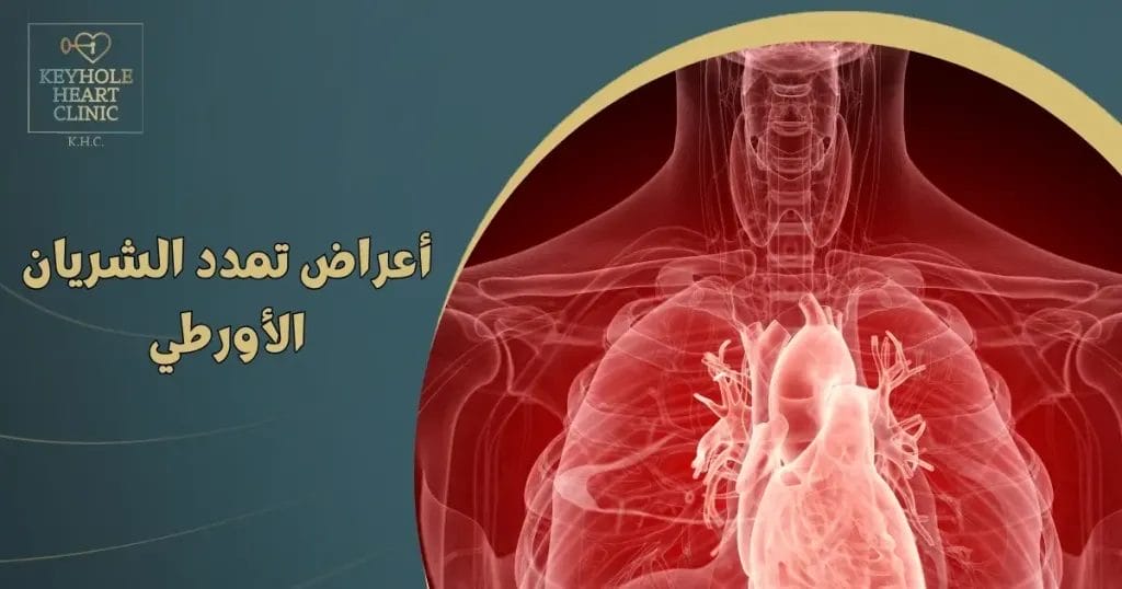 أعراض تمدد الشريان الأورطي البطني