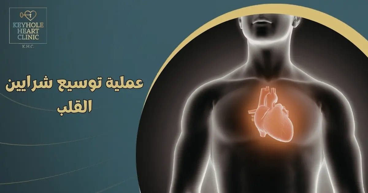 عملية توسيع شرايين القلب