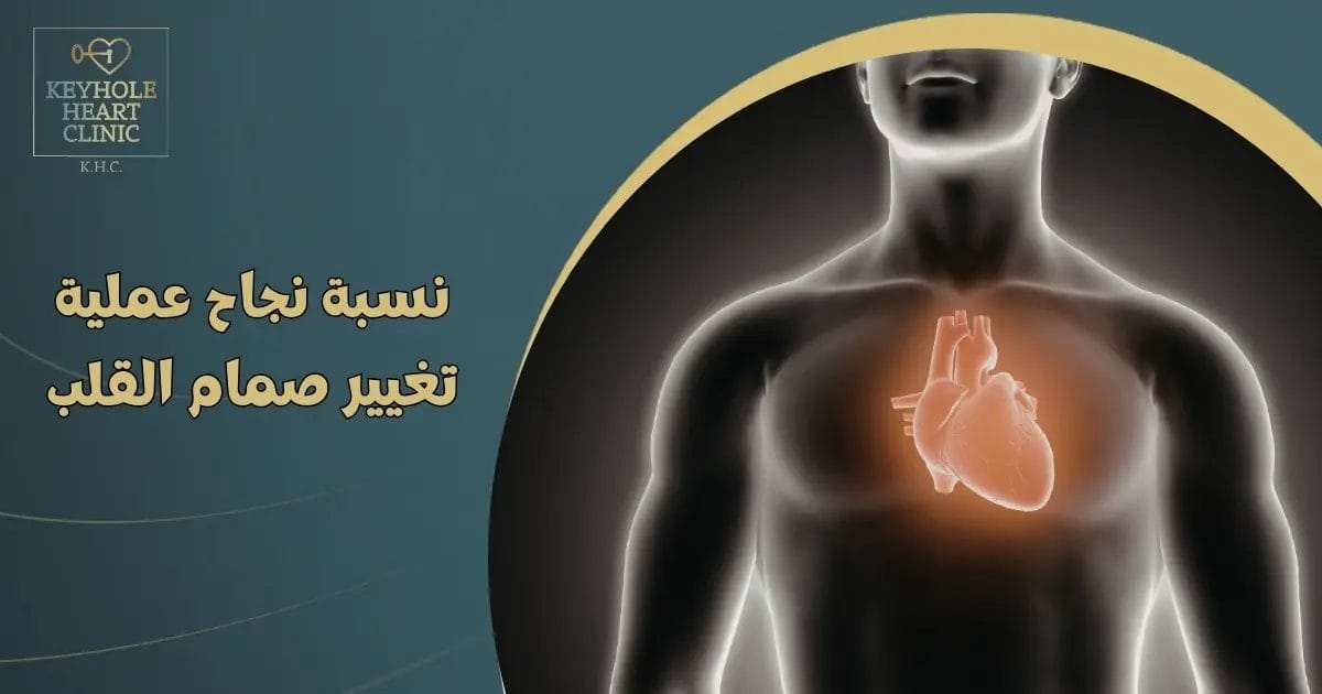 نسبة نجاح عملية تغيير صمام القلب