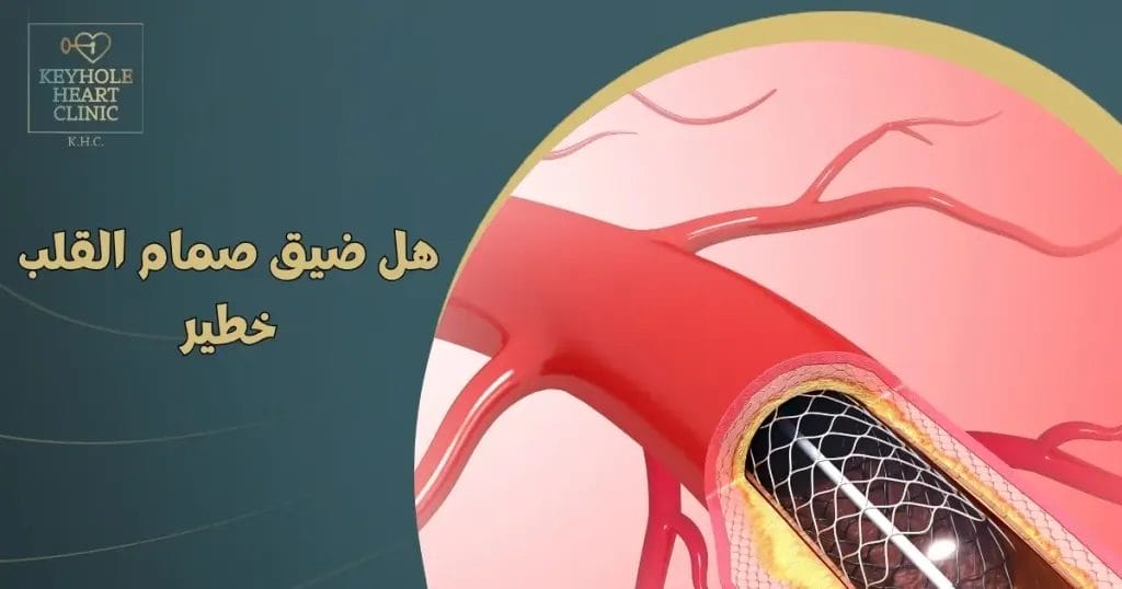 أعراض ضيق الصمام الاورطى