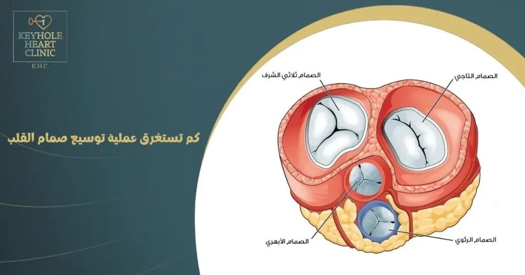 كم تستغرق عملية توسيع صمام القلب
