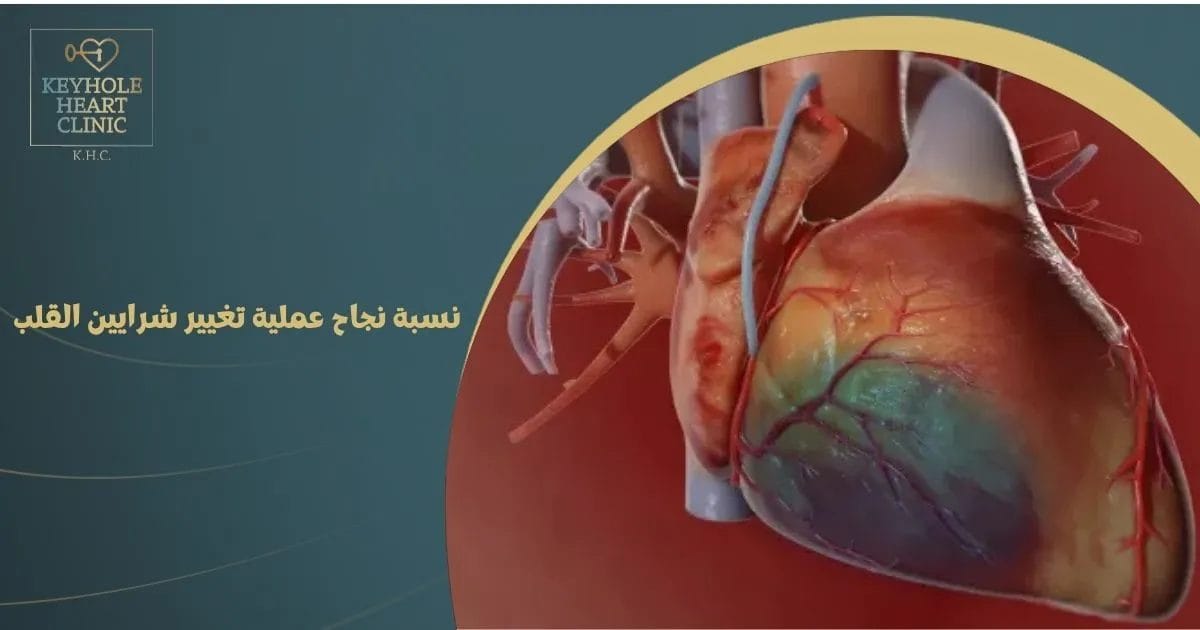 نسبة نجاح عملية تغيير شرايين القلب