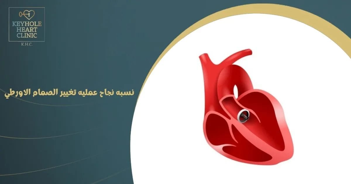 نسبه نجاح عمليه تغيير الصمام الاورطي