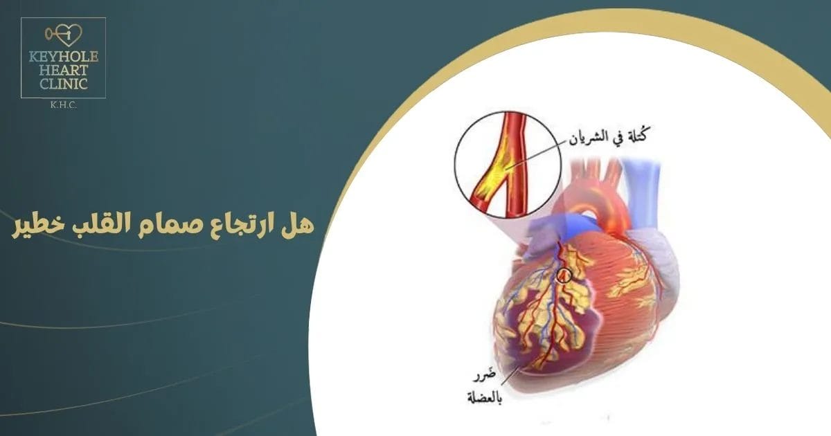 هل ارتجاع صمام القلب خطير ؟