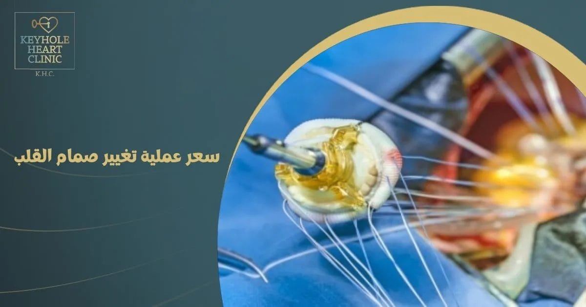 سعر عملية تغيير صمام القلب