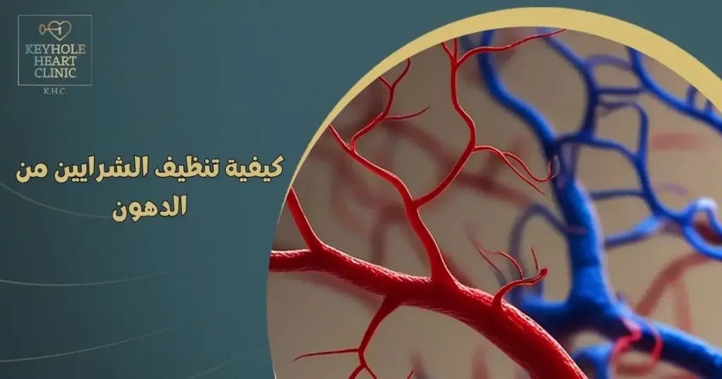 كيفية تنظيف الشرايين من الدهون