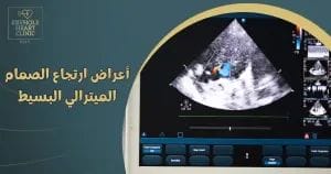 أعراض ارتجاع الصمام الميترالي البسيط