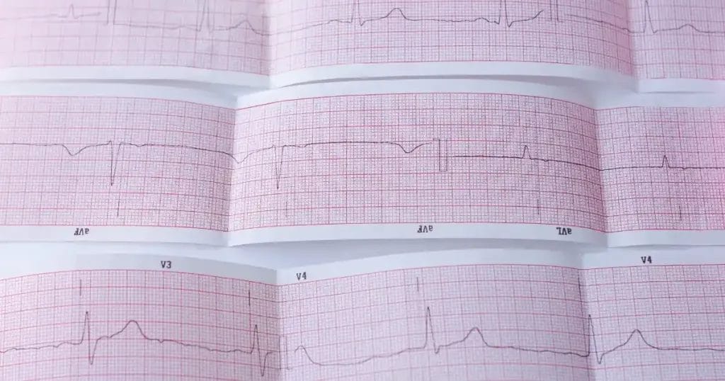 درجات ارتجاع الصمام الميترالي