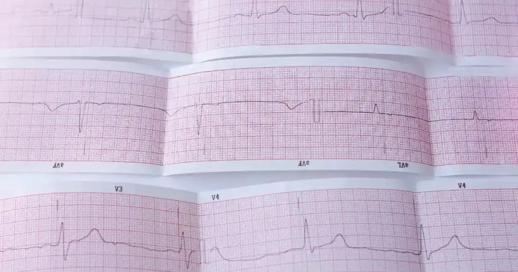 أمراض القلب الوراثية