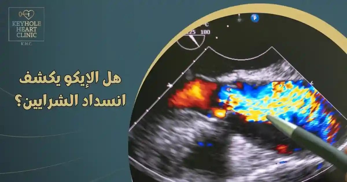 هل الإيكو يكشف انسداد الشرايين